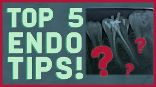 The Best 5 Root Canal Tips, Period