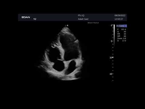 Кинопетли Edan Acclarix LX9 Кардиология