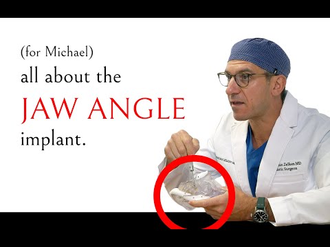 Jaw Angle Implants: Risks and Benefits — Dr. Jonathan Zelken