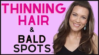 TRY THIS for THIN HAIR, BALD SPOTS & COWLICK PART! Watch them DISAPPEAR INSTANTLY!