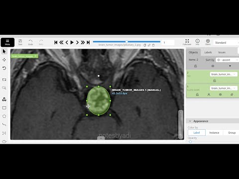 Preview of the medical image annotation tutorial