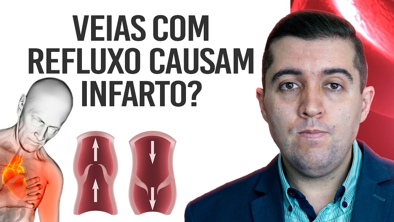 Qual relação entre refluxo de safena, veias doentes na perna com o coração e o infarto e a embolia?