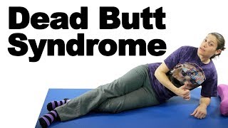 Dead Butt Syndrome, aka Gluteal Amnesia - Ask Doctor Jo