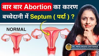 Reason for repeated abortion: Septum or curtain in the uterus? in Hindi By Dr. Priya Bhave Chittawar