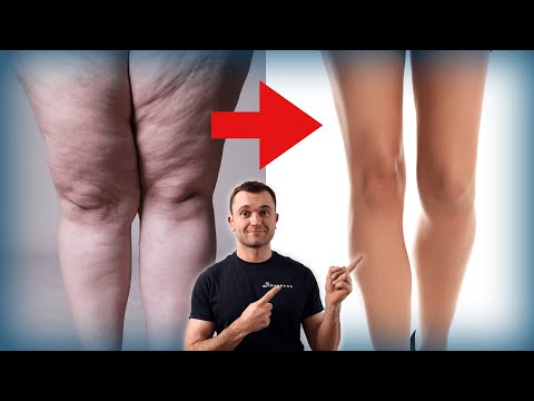 Slim legs - THIS is how you get them!
