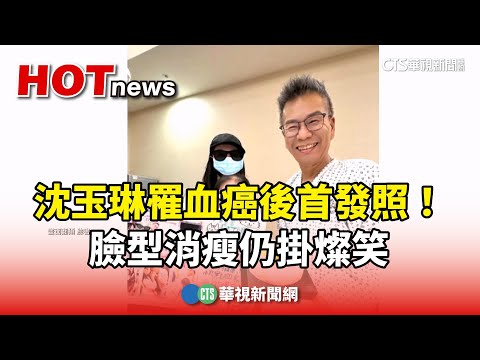 沈玉琳罹血癌後首發照！　臉型消瘦仍掛燦笑