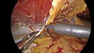 TARM : Linea Preservation | Technique