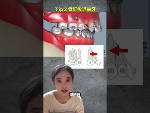 門牙作用