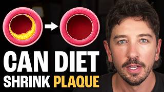 Can You Reverse Atherosclerosis With Diet | What 6 Major Clinical Trials Reveal | Simon Hill