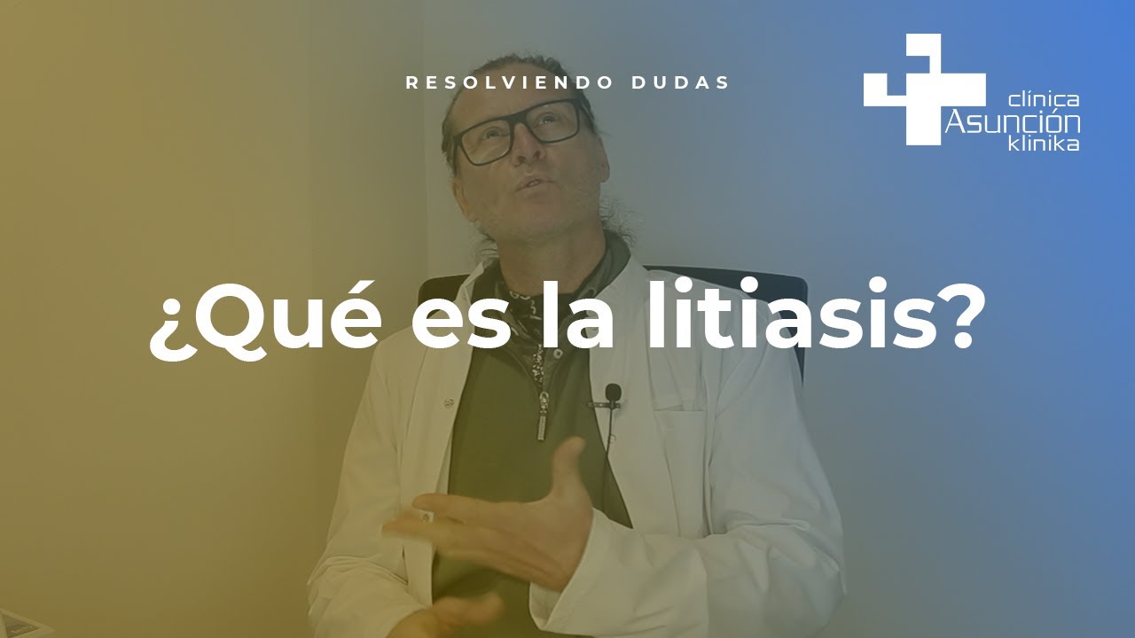 ¿Qué es la litiasis #ResolviendoDudas