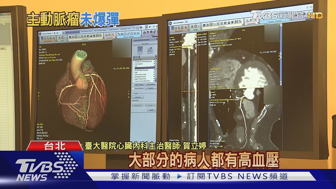 無聲殺手！突然出現這症狀　主動脈瘤破裂恐要命