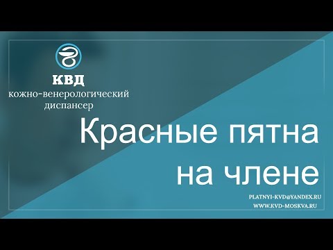 Макияж для девушки с веснушками темными волосами Пигментация кожи на ногах фото