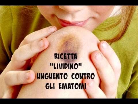 Pitiriasi versicolor sulla schiena Photo Giunti piedi doloranti dopo lallenamento