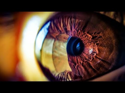 Panoptic Ophthalmoscope | How To Use | Ophthalmology | Diagnosis Video | Ep. No.3