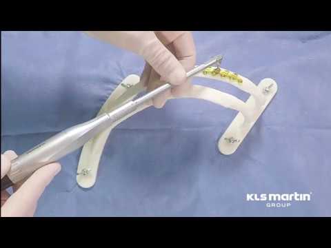 L1 Rib System Workshop Tutorial