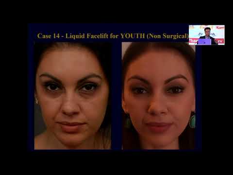 download lagu mp3 mp4 Breach Candy Hospital Mumbai Delivery Charges, download lagu Breach Candy Hospital Mumbai Delivery Charges gratis, unduh video klip Breach Candy Hospital Mumbai Delivery Charges