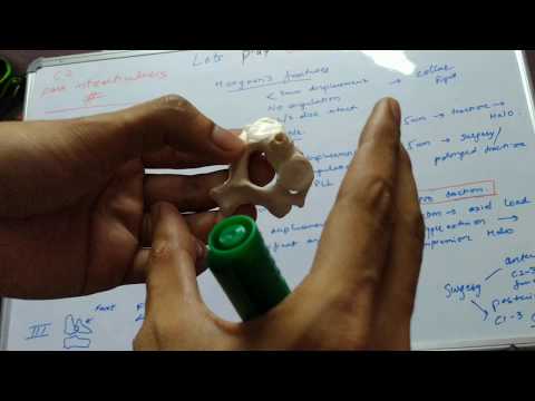 C2 pars interarticularis/ Hangman fractures