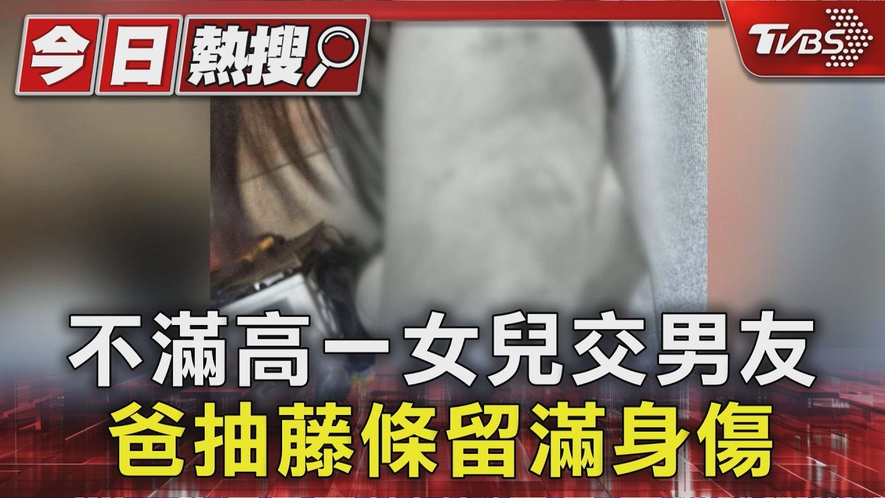 影音/高一女交男友惹怒單親爸!遭藤條狂打「全身瘀青」逃家求救