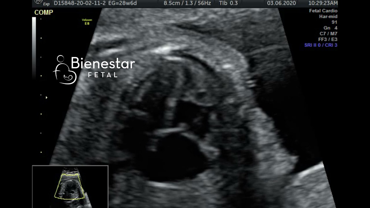 Jose Carlos Gutierrez Gutierrez-3