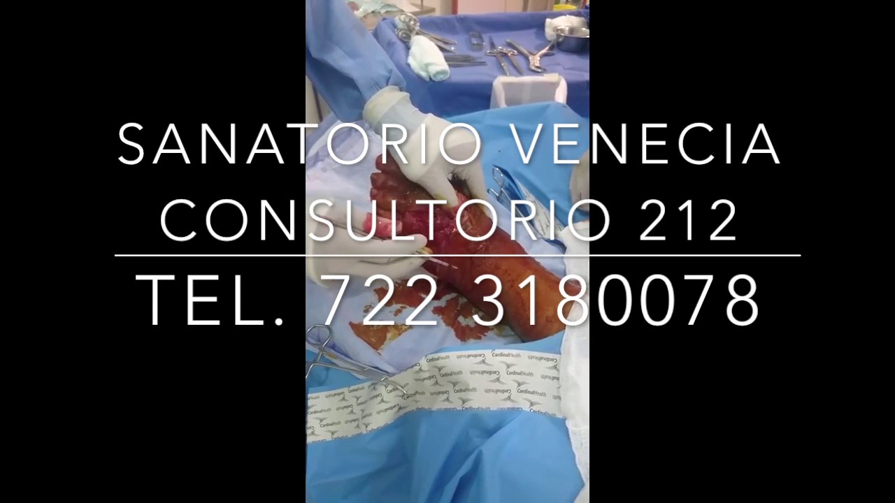 Jesús Montes De Oca Narváez-6