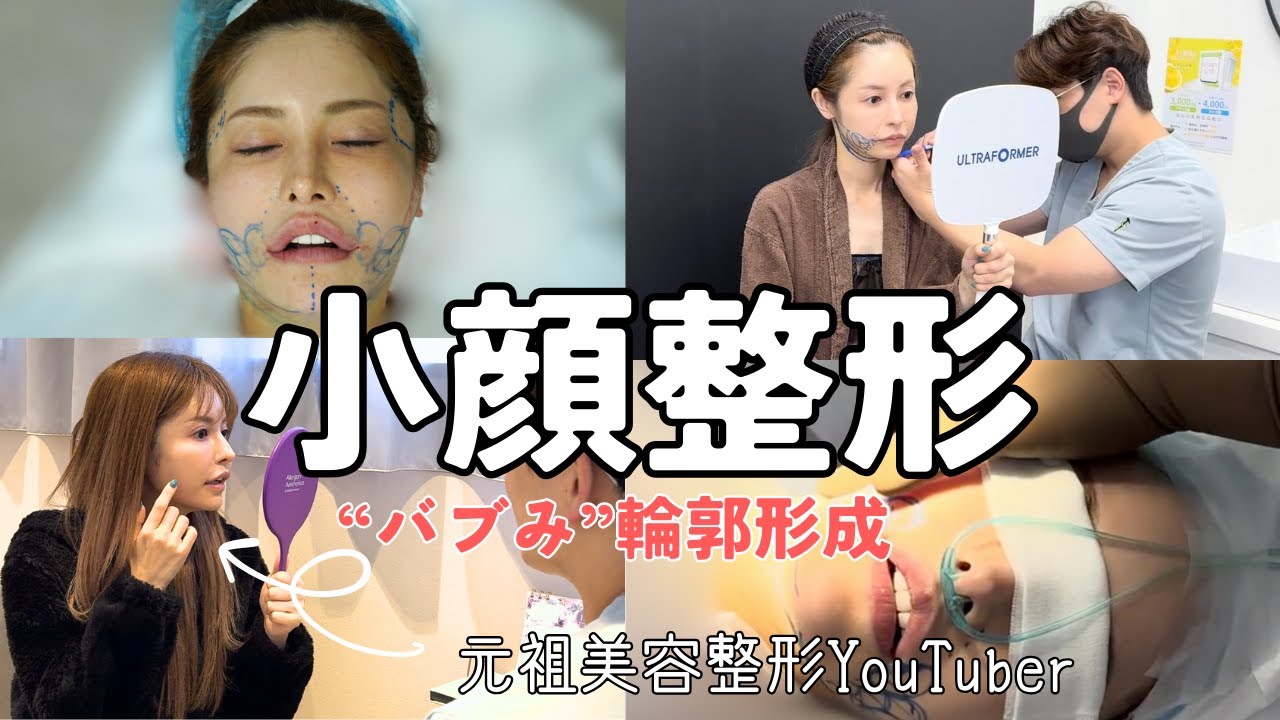 【アンチエイジング整形】“バブみ顔になる整形”のカウンセリングやデザイン、施術シーンを一部お見せします。