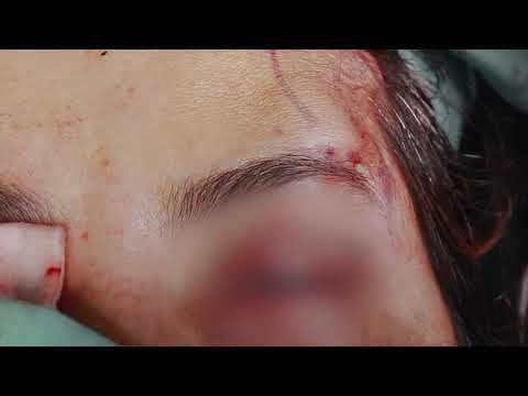 PEXIA DE CEJAS