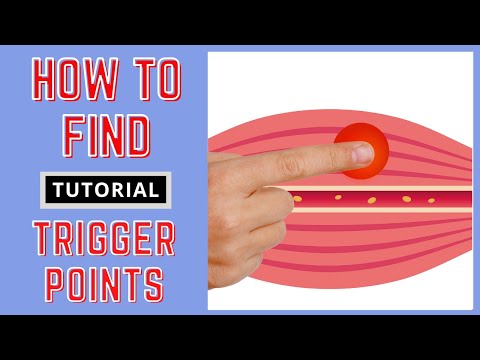 How to Find Trigger Points