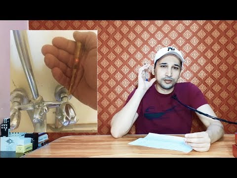 ماذا تفعل عندما يحدث تماس كهربي على السباكة والماء يكون متكرب