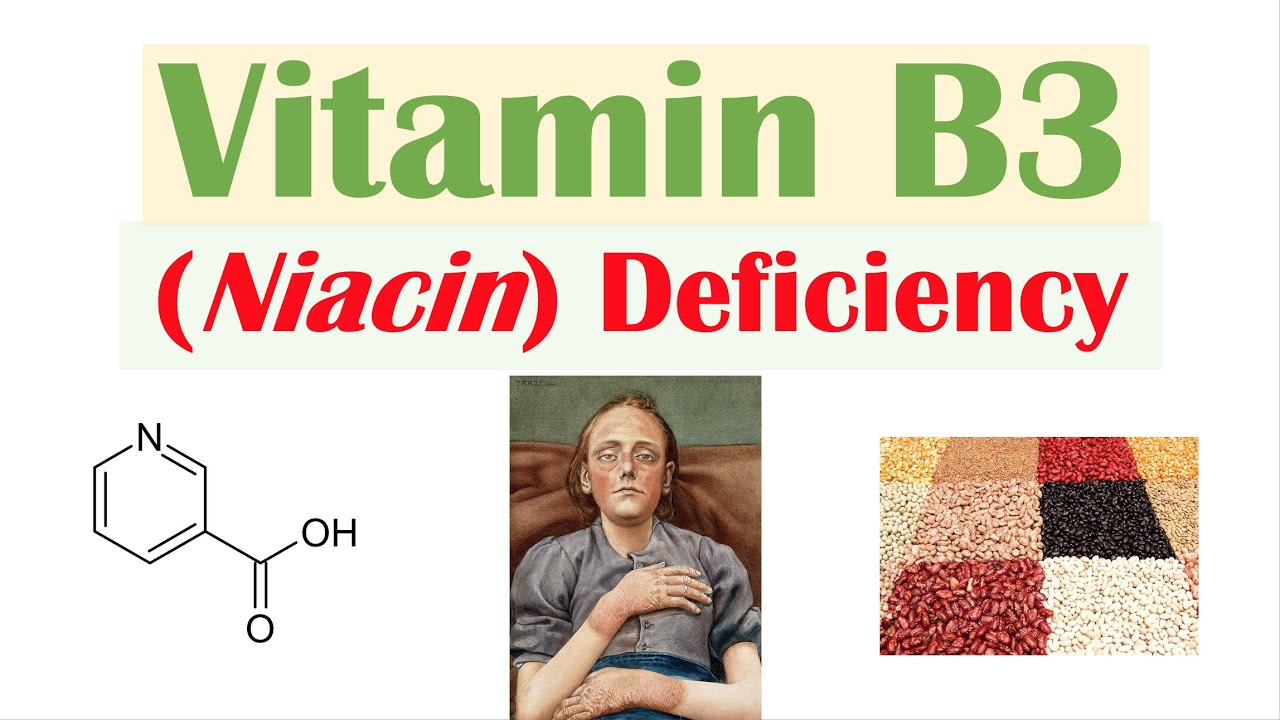 Vitamin B3 Niacin Deficiency (Pellagra) | Sources, Causes, Symptoms, Diagnosis, Treatment