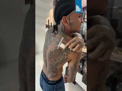 ANDERSON NEIFF - APÓS QUESTIONAMENTOS, CANTOR EXIBE FERIMENTO CAUSADO POR DISPARO EM SP