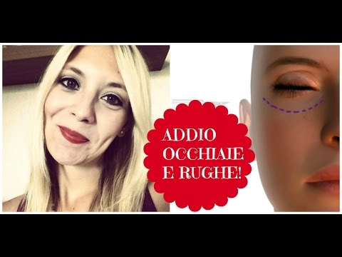 Cerchi scuri sotto occhi da fumo Unguento di geparinovy contro borse sotto occhi