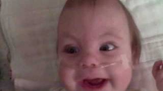 preview picture of video 'Abigail Hope 211 Trisomy 18 Baby One year old Laughing and playing!'