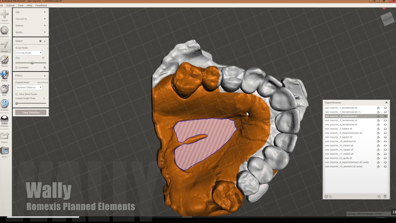Romexis Guide Module