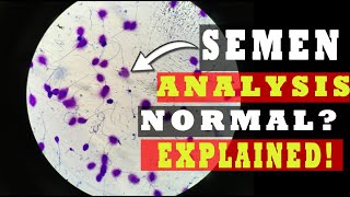 What is Semen Analysis Test | Procedure, Normal & Abnormal Report [EXPLAINED!]
