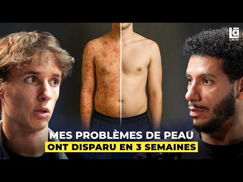 L'alimentation anti-inflammatoire a changé ma vie - Mat Resume