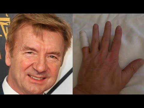 Dancing On Ice's Christopher Dean in unfortunate accident as he breaks a bone just days before..