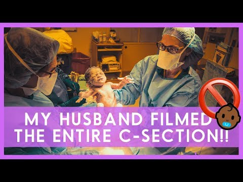 GENTLE C SECTION BIRTH VIDEO (w/ Cholestasis During Pregnancy) | Sippers' Birth Stories (Part 3)