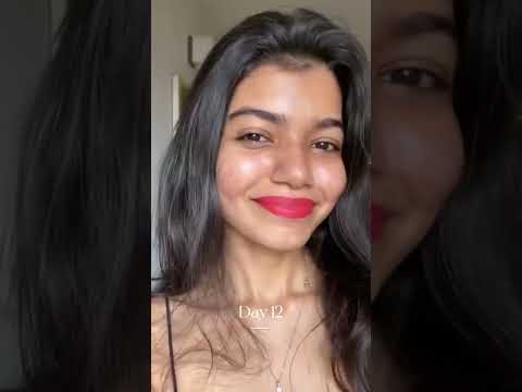 Isotretinoin 10 Mg Capsules - Skin care medicine supplier from india