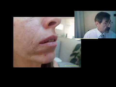 Ağız açık kalırsa kokar Murat Aydın