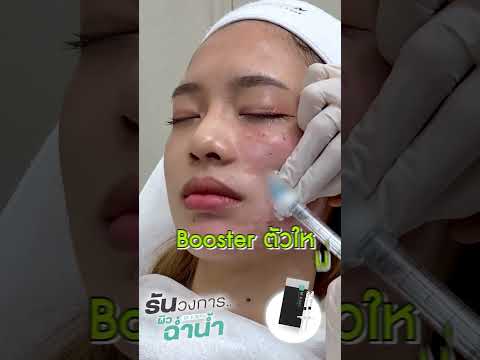 ฉีด Rejuran Skin Booster ฟื้นฟูผิวฉ่ำวาว ผิวแข็งแรง หมอบาส