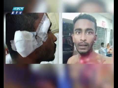 এস এম হলের ঘটনার ব্যবস্থা নেয়ার আশ্বাস