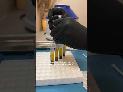 Santé Clínica Estética Barcelona