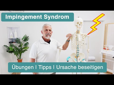 Shoulder impingement syndrome ✅ Causes, exercises & shoulder support explained (including univers...