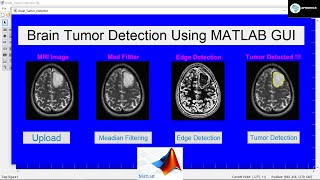 Download the video "Brain Tumor Detection Using MATLAB GUI with Source Code [Image Processing 2022]"