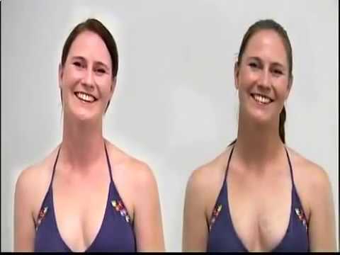 Kung paano mapupuksa ang taba sa mga gilid Diyeta pagbaba ng timbang sa hips at