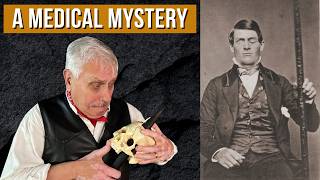 Phineas Gage: The Unbelievable True Story of the Man Who Defied Death