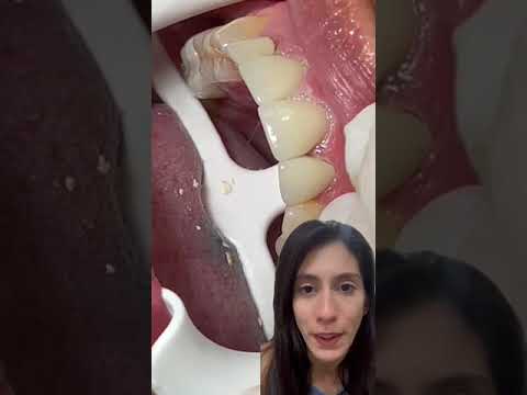 video JmSpHAR_o0Y