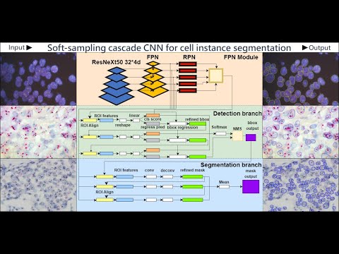 用於自動量化 HER2 擴增水準的細胞實例分割技術 (Cell Instance Segmentation for Automated quantifcation of HER2 amplification levels)