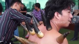 Download lagu Terapi Bekam Tanduk Sapi | RAGAM INDONESIA (25/05/23) mp3