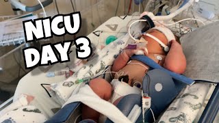 Blood Clot The Size of an Egg?! | NICU Journey Day 3 | Vlog 266